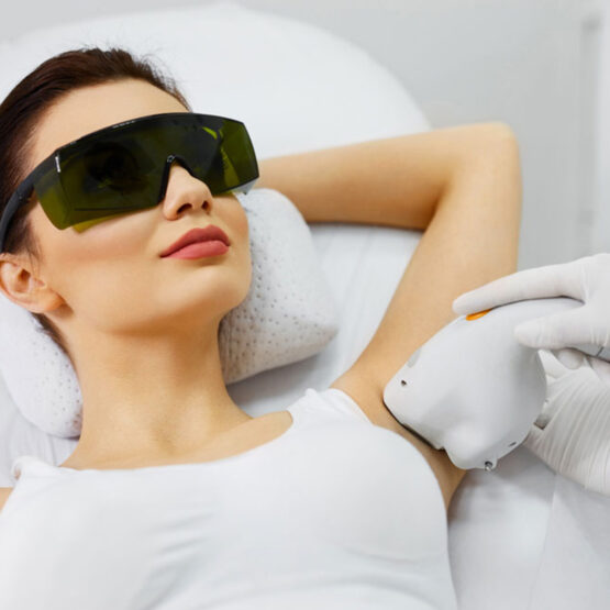 Diode laser for hair removal