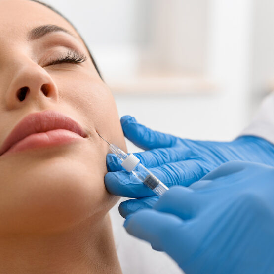 Filler di acido ialuronico